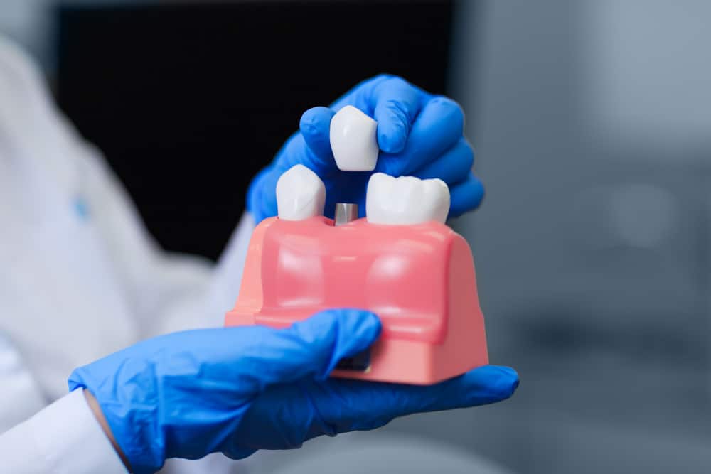 dental implant restoration procedure