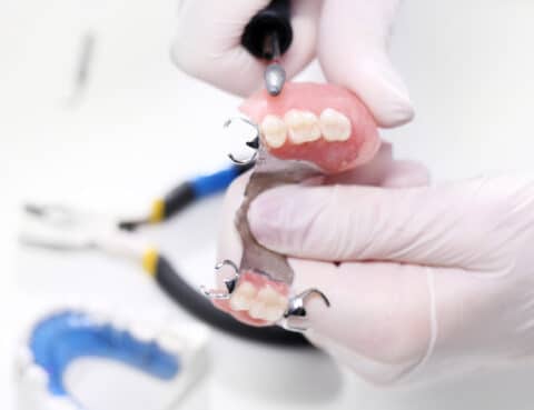 Dentures,,Oral,Hygiene.,Prosthetics,Hands,While,Working,On,The,Denture,