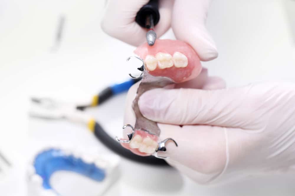 Dentures,,Oral,Hygiene.,Prosthetics,Hands,While,Working,On,The,Denture,