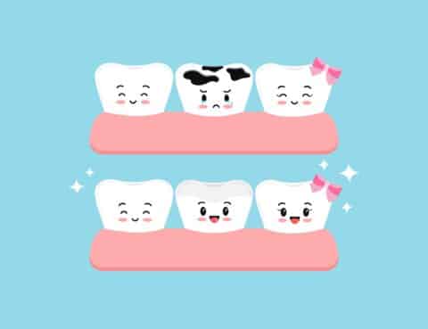 Cute teeth before and after multiple caries in gym dental characters. Tooth dentistry restoration with ceramic porcelain sealant in cavity treatment concept. Flat cartoon clip art vector illustration.