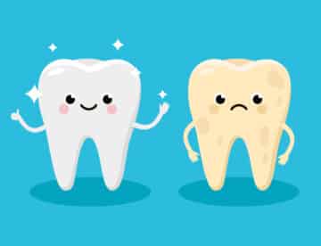 Cleaning and whitening teeth concept vector illustration. Snow-white Happy Tooth and Yellow Moody Tooth Cartoon characters in flat design. Tooth before and after whitening infographic elements.