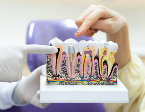 dentist showing tooth model to teach patient to take care of dental health, prevent dental carries and explain treatment option. orthodontics and medical concept