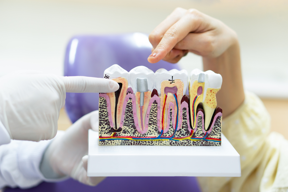 dentist showing tooth model to teach patient to take care of dental health, prevent dental carries and explain treatment option. orthodontics and medical concept