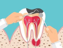 Dentist holding instruments and examining patient teeth. Teeth examination dentistry concept.